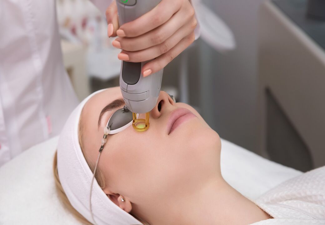 Laser noorendamine
